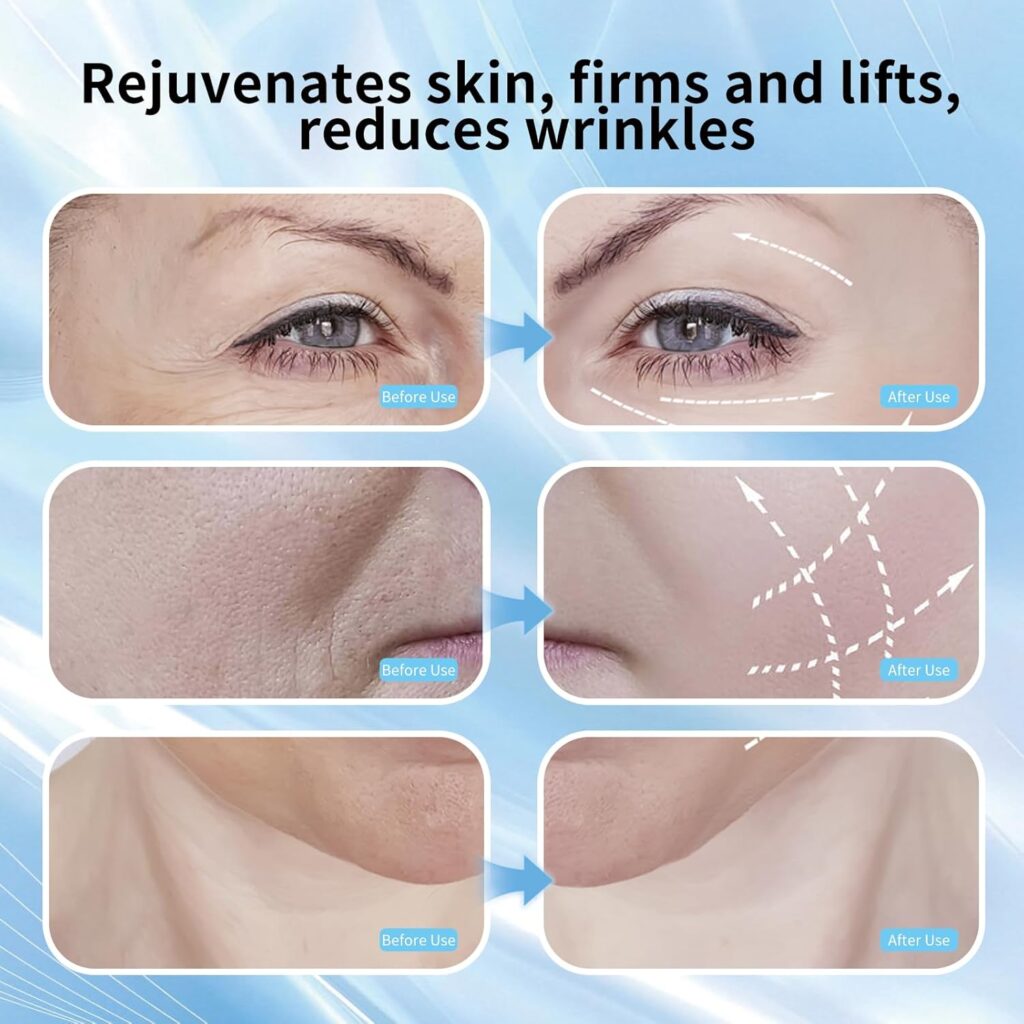 massaggiatore viso EMS antirughe Calason lifting viso LED doppio mento dispositivo bellezza